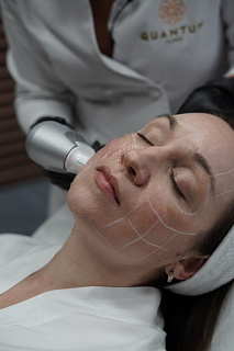 Аппаратная косметология